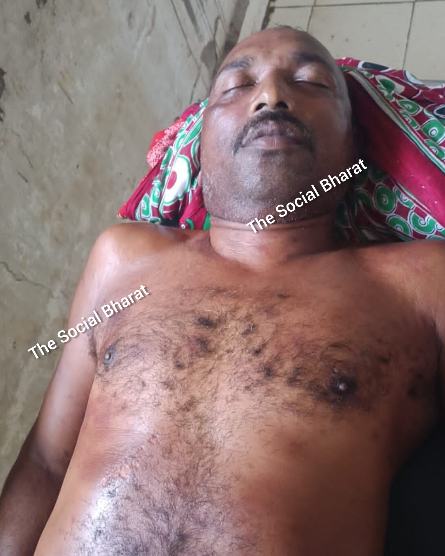 Rajnagar Lightning Death: राजनगर में आकाशीय बिजली का कहर, दो ग्रामीणों की मौत 15