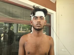 Jamshedpur Crime News: बर्मामाइंस में ऑटो चालक पर चापड़ से हमला, परिवार को जान का खतरा; आरोपियों पर कार्रवाई की मांग